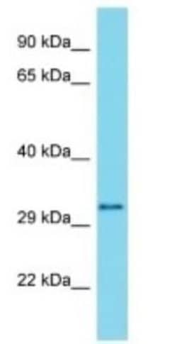 METTL21C Rabbit anti-Human, Polyclonal, Novus Biologicals:Antibodies:Primary